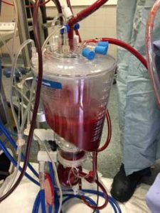 Preserve kidneys without cold storage